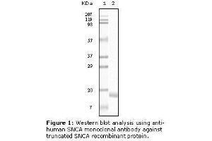 Image no. 2 for anti-Synuclein, alpha (SNCA) antibody (ABIN232104) (SNCA antibody)