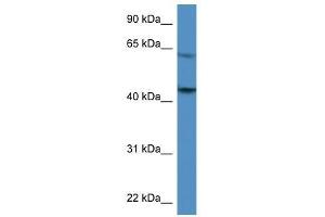 F2R antibody used at 0. (PAR1 antibody  (C-Term))
