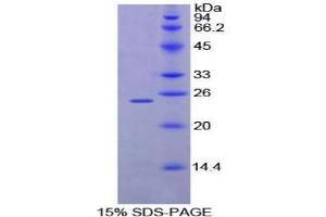 SDS-PAGE analysis of Mouse MPL Protein. (MPL 蛋白)