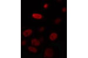 ABIN6274327 staining HuvEc cells by IF/ICC. (Nuclear Factor 1 antibody)