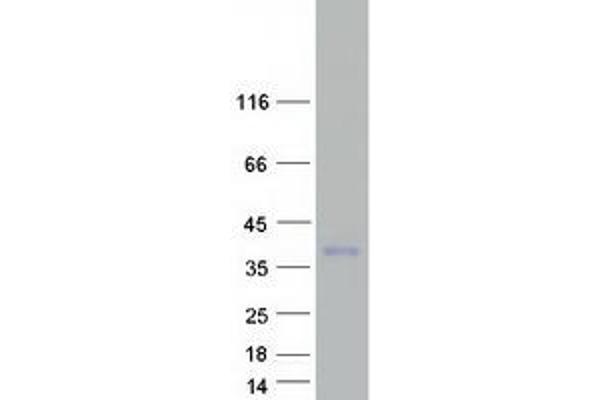 TARM1 Protein (Myc-DYKDDDDK Tag)