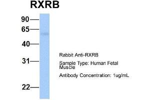 Host:  Rabbit  Target Name:  RXRB  Sample Type:  Human Fetal Muscle  Antibody Dilution:  1. (Retinoid X Receptor beta antibody  (N-Term))