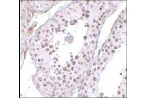 Immunohistochemistry of MED4 in human testis tissue with this product at 10 μg/ml. (MED4 antibody  (C-Term))