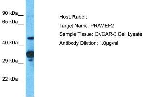 Host: Rabbit Target Name: PRAMEF2 Sample Tissue: Human OVCAR-3 Whole Cell Antibody Dilution: 1ug/ml (PRAMEF2 antibody  (C-Term))