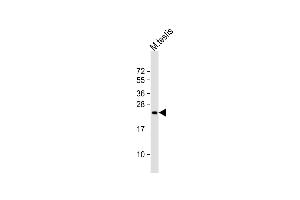 Anti-FEV Antibody (N-Term) at 1:2000 dilution + mouse testis lysate Lysates/proteins at 20 μg per lane. (FEV antibody  (AA 53-86))