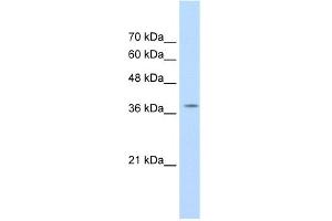 WB Suggested Anti-RALY Antibody Titration:  1. (Raly antibody  (C-Term))