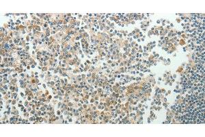 Immunohistochemistry of paraffin-embedded Human tonsil using NDRG3 Polyclonal Antibody at dilution of 1:70 (NDRG3 antibody)