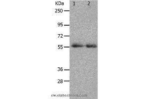 Western blot analysis of K562 cell and human colon cancer tissue, using MMP17 Polyclonal Antibody at dilution of 1:900 (MMP17 antibody)