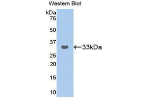 Western blot analysis of the recombinant protein. (GRAP2 antibody  (AA 77-325))