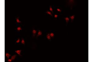 ABIN6266919 staining HeLa  cells by IF/ICC. (ZNF174 antibody  (Internal Region))