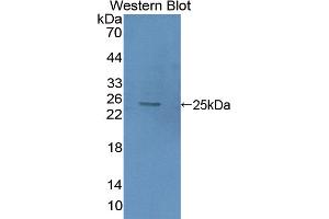 Figure. (HMGB2 antibody  (AA 2-187))