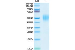 Human FGFR2 beta (IIIb) on Tris-Bis PAGE under reduced conditions. (FGFR2 beta (AA 152-378) protein (His tag))