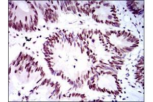 Immunohistochemistry (IHC) image for anti-Replication Protein A1, 70kDa (RPA1) antibody (ABIN969564)