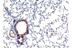 Immunohistochemical analysis of paraffin-embedded Mouse Lung Tissue using TGFβ1 Mouse mAb diluted at 1:200. (TGFB1 antibody)