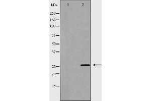 Western blot analysis of A431  lysate using PRKCD antibody. (PSMB1 antibody  (Internal Region))