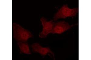 ABIN6266591 staining NIH-3T3 by IF/ICC. (MMP14 antibody  (C-Term))