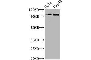 Western Blot Positive WB detected in Hela whole cell lysate,HepG2 whole cell lysate All lanes Phospho-NBN antibody at 1. (Recombinant Nibrin antibody  (pSer343))