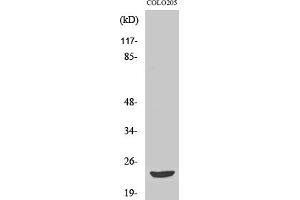 Western Blot analysis of various cells using Mob3B Polyclonal Antibody. (MOBKL2B antibody  (AA 40-120))