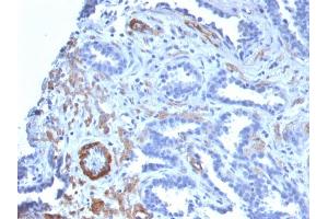 Immunohistochemistry (IHC) image for anti-Myosin Heavy Chain 11, Smooth Muscle (MYH11) antibody (ABIN6940158)