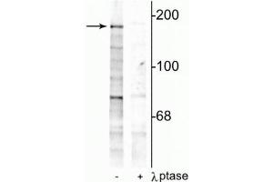 Western blot of rat hippocampal lysate showing specific immunolabeling of the ~180 kDa NR2B subunit phosphorylated at Tyr1252 in the first lane (-). (GRIN2B antibody  (pTyr1252))