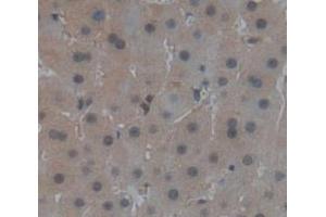 IHC-P analysis of Human Tissue, with DAB staining. (PPARG antibody  (AA 349-488))