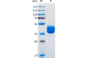 Human ADA Protein, hFc Tag on SDS-PAGE under reducing condition. (Adenosine A2a Receptor Protein (ADORA2A) (AA 1-7) (Fc Tag))