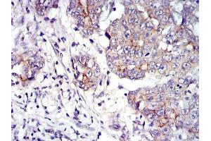 Immunohistochemistry (IHC) image for anti-Junction Plakoglobin (JUP) antibody (ABIN969225)