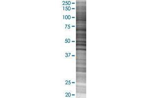 MED18 transfected lysate. (MED18 293T Cell Transient Overexpression Lysate(Denatured))