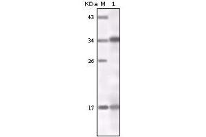 Western blot analysis using IFN-gamma mouse mAb against IFN-gamma recombinant protein. (Interferon gamma antibody)