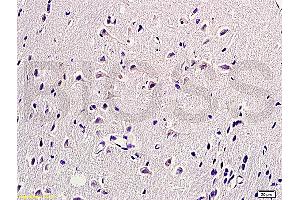 Formalin-fixed and paraffin embedded rat brain labeled with  (ABIN672441)  Rabbit Anti-HSP27 HspB1 HSP25 Polyclonal Antibody, unconjugated 1: 200 followed by incubation with conjugated secondary antibody and DAB staining. (HSP27 antibody  (AA 101-205))