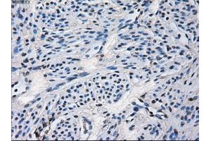 Immunohistochemical staining of paraffin-embedded Ovary tissue using anti-CYP2E1 mouse monoclonal antibody. (CYP2E1 antibody)