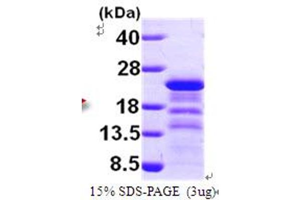 HIV-1 p24 Protein (AA 155-321) (His tag)