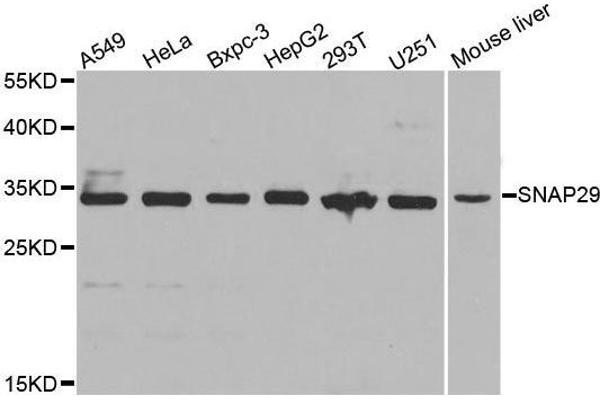 SNAP29 antibody  (AA 1-258)