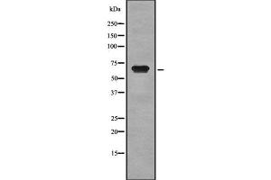 Western blot analysis of CD42b using MCF7 whole cell lysates (CD42b antibody  (C-Term))