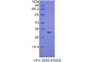 SDS-PAGE analysis of Rabbit PPARG Protein. (PPARG Protein)