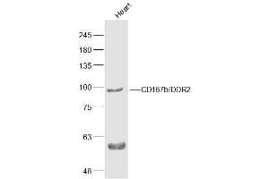 Mouse Heart lysates probed with CD167b'DDR2 Polyclonal Antibody, Unconjugated  at 1:500 dilution and 4˚C overnight incubation. (DDR2 antibody  (AA 245-350))