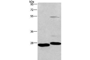 Western Blot analysis of Mouse intestinum tenue and heart tissue using CIDEC Polyclonal Antibody at dilution of 1:551 (CIDEC antibody)