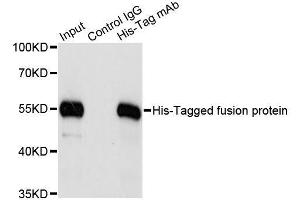 Immunoprecipitation of over-expressed His-tagged protein in 293T cells incubated using His-tag antibody. (His Tag antibody)