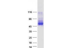 TMEM51 Protein (Transcript Variant 2) (Myc-DYKDDDDK Tag)