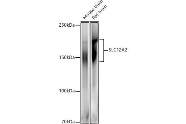 SLC12A2 antibody  (AA 120-280)