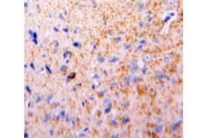 Used in DAB staining on fromalin fixed paraffin-embedded Brain tissue (Lipoprotein Lipase antibody  (AA 55-316))