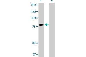 Western Blot analysis of HABP2 expression in transfected 293T cell line by HABP2 MaxPab polyclonal antibody. (HABP2 antibody  (AA 1-560))