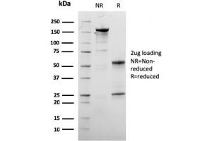 SDS-PAGE Analysis Purified Dystrophin Monospecific Mouse Monoclonal Antibody (DMD/3245). (Dystrophin antibody  (AA 114-263))