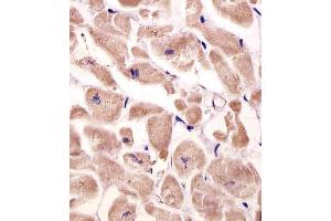 Immunohistochemistry (Paraffin-embedded Sections) (IHC (p)) image for anti-Very Low Density Lipoprotein Receptor (VLDLR) (AA 484-510) antibody (ABIN651940)