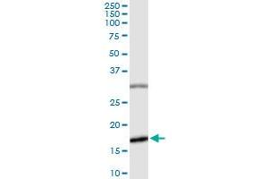 Immunoprecipitation of BIRC5 transfected lysate using rabbit polyclonal anti-BIRC5 and Protein A Magnetic Bead (BIRC5 (Human) IP-WB Antibody Pair)