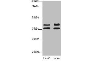 Western blot All lanes: IKBIPantibody at 2. (IKbIP antibody  (AA 121-350))