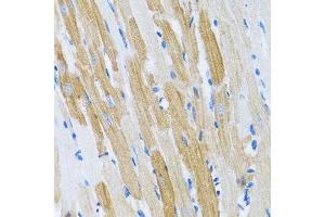 Immunohistochemistry of paraffin-embedded rat heart using WFDC2 antibody at dilution of 1:100 (40x lens). (WFDC2 antibody)