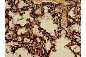 Immunohistochemistry of paraffin-embedded human lung tissue using ABIN7166683 at dilution of 1:100 (APOBEC4 antibody  (AA 221-367))
