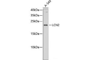 Western blot analysis of extracts of A-549 cells using LCN2 Polyclonal Antibody at dilution of 1:1000. (Lipocalin 2 antibody)