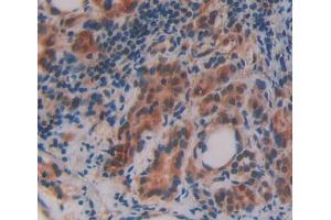 IHC-P analysis of thyroid tissue, with DAB staining. (OSBP antibody  (AA 546-807))